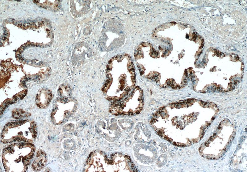 Immunohistochemistry of paraffin-embedded human prostate hyperplasia slide using Catalog No:110415(EXOSC9 Antibody) at dilution of 1:50