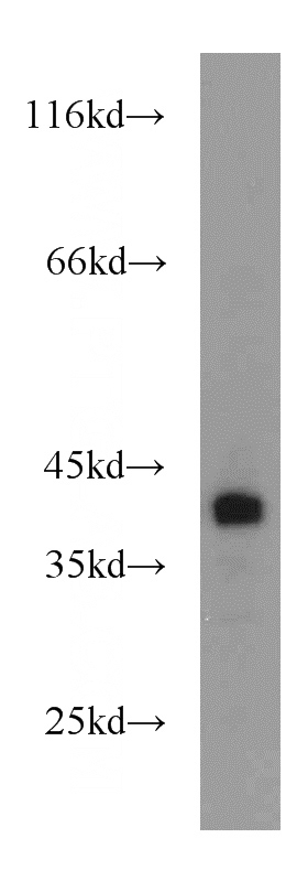 mouse kidney tissue were subjected to SDS PAGE followed by western blot with Catalog No:117143(SH3GLB1 antibody) at dilution of 1:1000