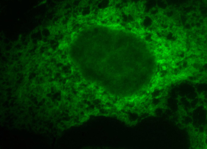 Immunofluorescent analysis of A431 cells, using CANX antibody Catalog No:108832 at 1:50 dilution and FITC-labeled donkey anti-rabbit IgG(green).
