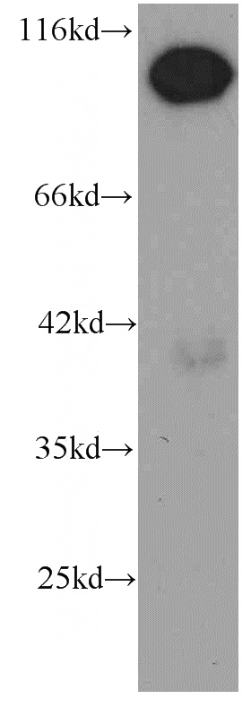 HeLa cells were subjected to SDS PAGE followed by western blot with Catalog No:107500(RBM15 antibody) at dilution of 1:1000