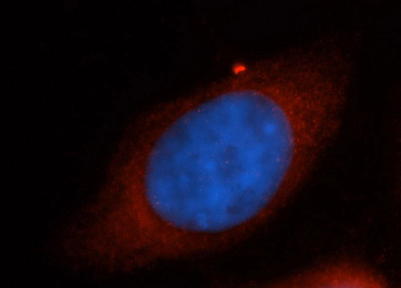 Immunofluorescent analysis of MCF-7 cells, using RPS26 antibody Catalog No:114837 at 1:50 dilution and Rhodamine-labeled goat anti-rabbit IgG (red). Blue pseudocolor = DAPI (fluorescent DNA dye).