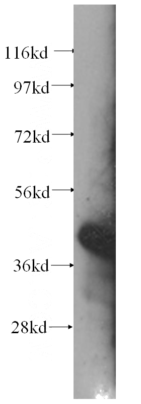 HeLa cells were subjected to SDS PAGE followed by western blot with Catalog No:107371(LAMR1,RPSA antibody) at dilution of 1:500