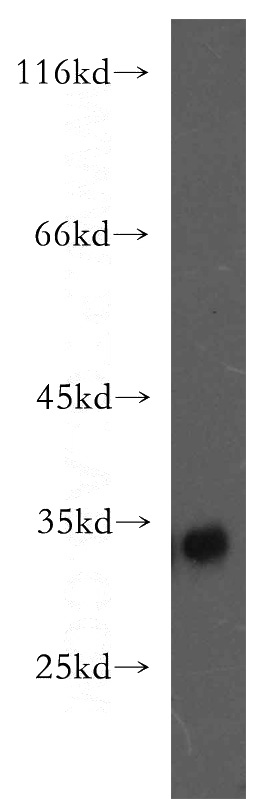 K-562 cells were subjected to SDS PAGE followed by western blot with Catalog No:110651(FHL3 antibody) at dilution of 1:500