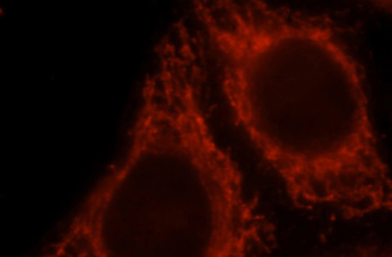 Immunofluorescent analysis of HepG2 cells, using BCL2L13 antibody Catalog No:117098 at 1:25 dilution and Rhodamine-labeled goat anti-rabbit IgG (red).