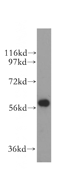 human heart tissue were subjected to SDS PAGE followed by western blot with Catalog No:107971(ALDH4A1 antibody) at dilution of 1:400