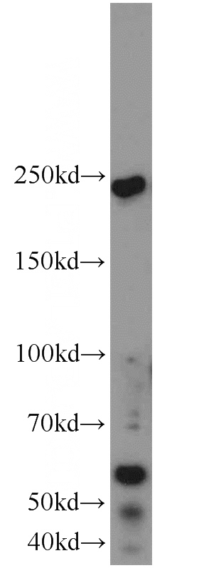 mouse brain tissue were subjected to SDS PAGE followed by western blot with Catalog No:116483(TUB antibody) at dilution of 1:1000