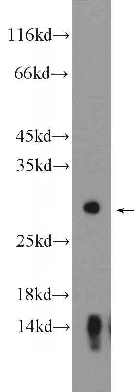 mouse pancreas tissue were subjected to SDS PAGE followed by western blot with Catalog No:111903(KLK2 Antibody) at dilution of 1:300