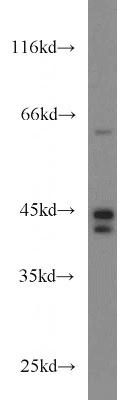 HeLa cells were subjected to SDS PAGE followed by western blot with Catalog No:116289(TNFR1 antibody) at dilution of 1:500