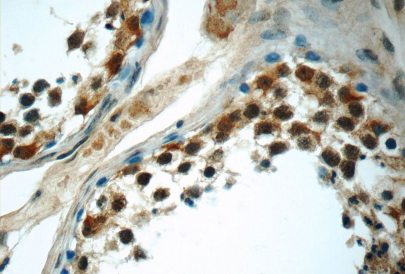 Immunohistochemistry of paraffin-embedded human testis tissue slide using Catalog No:111410(HIVEP1 Antibody) at dilution of 1:50 (under 40x lens)