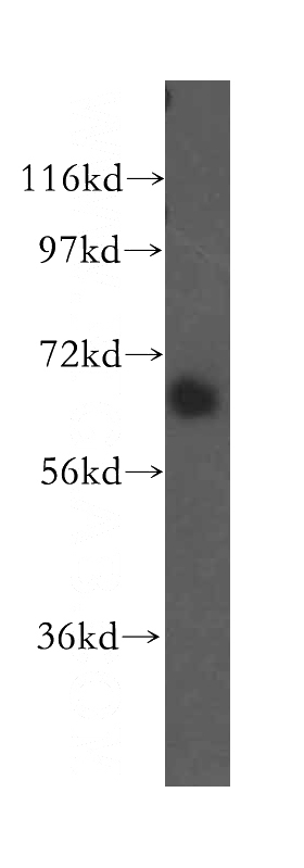 human liver tissue were subjected to SDS PAGE followed by western blot with Catalog No:115079(SEC24A antibody) at dilution of 1:500