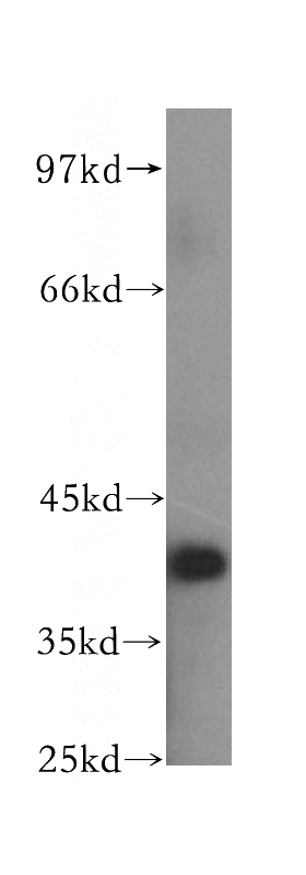 HeLa cells were subjected to SDS PAGE followed by western blot with Catalog No:117220(BPNT1 antibody) at dilution of 1:500