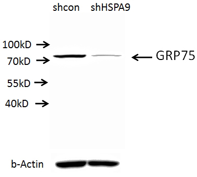 A549 cells (shcontrol and shRNA of GRP75)were subjected to SDS PAGE followed by western blot with Catalog No:111220 (GRP75 antibody) at dilution of 1:500. (Data provided by Angran Biotech (www.miRNAlab.com)).