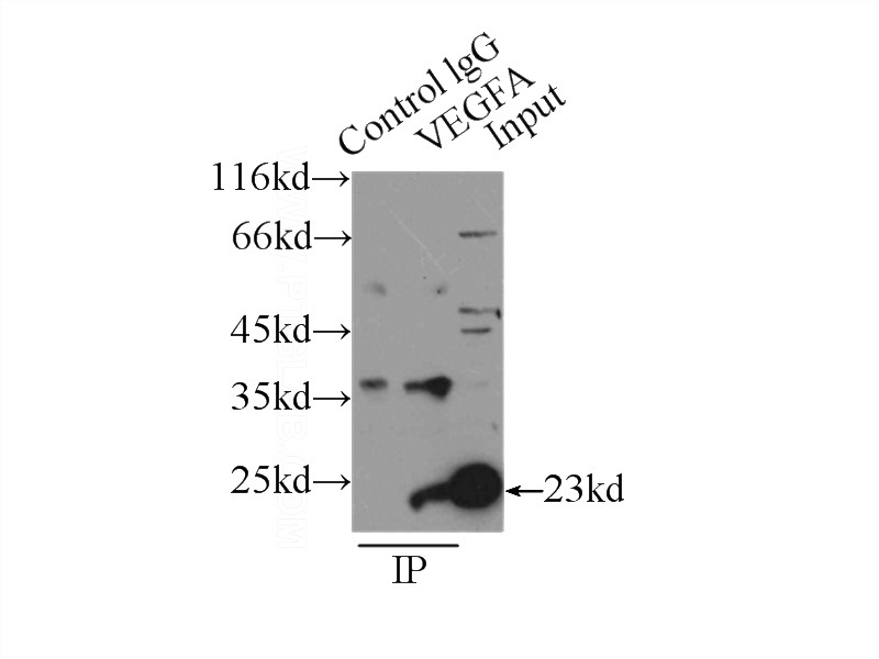 IP Result of anti-VEGFA (IP:Catalog No:116735, 3ug; Detection:Catalog No:116735 1:500) with MCF-7 cells lysate 2500ug.