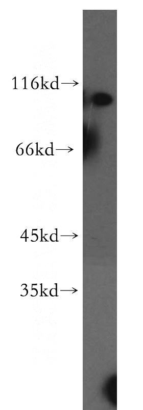 HeLa cells were subjected to SDS PAGE followed by western blot with Catalog No:114497(RABGAP1L antibody) at dilution of 1:1000