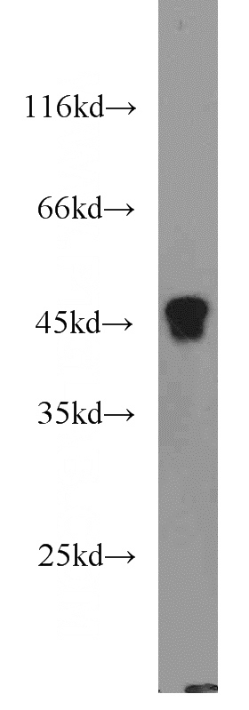 human blood tissue were subjected to SDS PAGE followed by western blot with Catalog No:108022(APOA4 antibody) at dilution of 1:1000