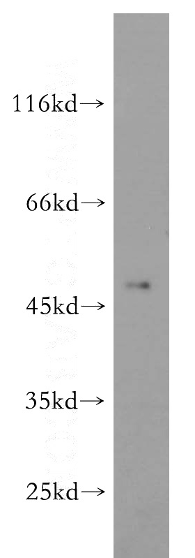 HeLa cells were subjected to SDS PAGE followed by western blot with Catalog No:110279(ELK4 antibody) at dilution of 1:800