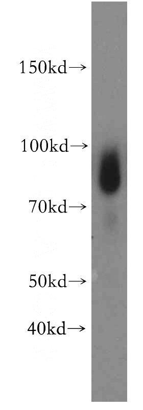 human testis tissue were subjected to SDS PAGE followed by western blot with Catalog No:116460(TXNRD3 antibody) at dilution of 1:300