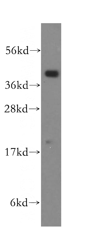 mouse lung tissue were subjected to SDS PAGE followed by western blot with Catalog No:114199(PRKCDBP antibody) at dilution of 1:400