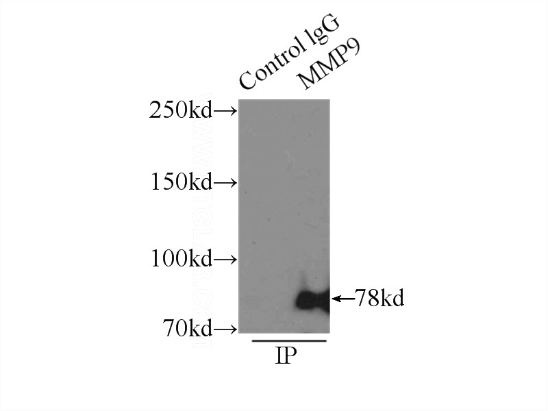 IP Result of anti-MMP9 (IP:Catalog No:112709, 3ug; Detection:Catalog No:112709 1:300) with Jurkat cells lysate 4000ug.