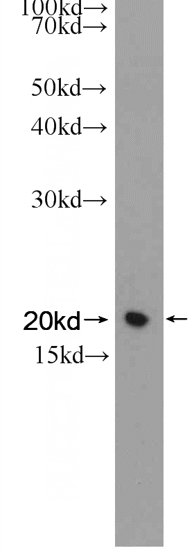 rat stomach tissue were subjected to SDS PAGE followed by western blot with Catalog No:116335(Transgelin-2-specific Antibody) at dilution of 1:600