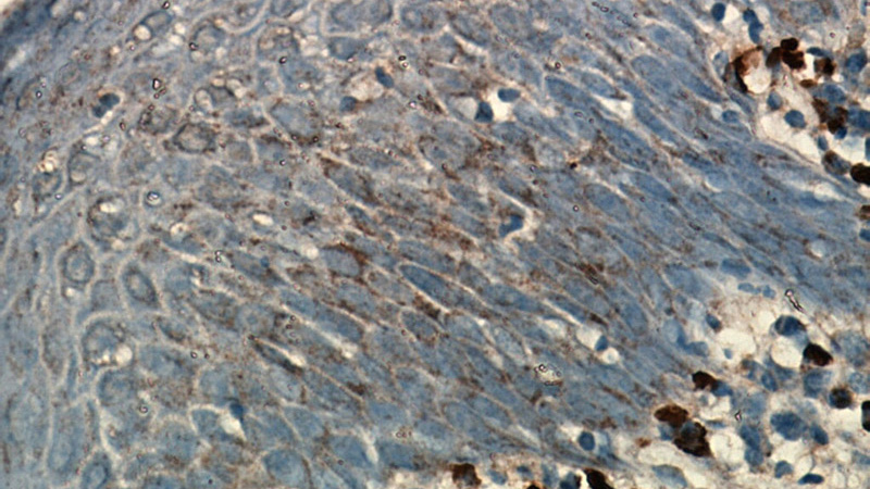 Immunohistochemical of paraffin-embedded human tonsil using Catalog No:107043(SDC1,CD138 antibody) at dilution of 1:50 (under 40x lens)