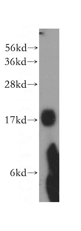 A375 cells were subjected to SDS PAGE followed by western blot with Catalog No:113179(NHP2 antibody) at dilution of 1:300