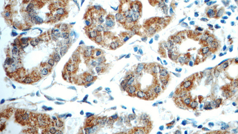 Immunohistochemistry of paraffin-embedded human stomach tissue slide using Catalog No:107759(ADA Antibody) at dilution of 1:50 (under 40x lens)