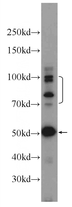 mouse testis tissue were subjected to SDS PAGE followed by western blot with Catalog No:115496(SLC5A5 Antibody) at dilution of 1:600