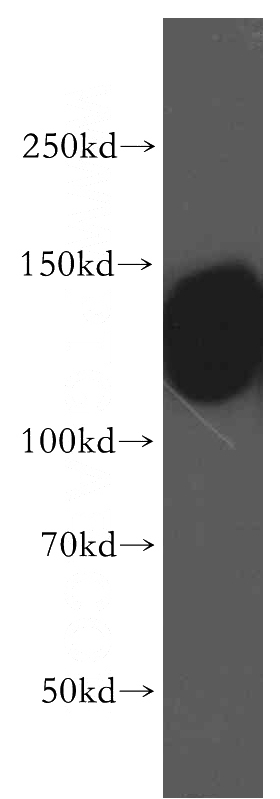 human brain tissue were subjected to SDS PAGE followed by western blot with Catalog No:114020(ATP2B2 antibody) at dilution of 1:500