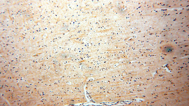Immunohistochemical of paraffin-embedded human brain using Catalog No:110324(ENPP4 antibody) at dilution of 1:100 (under 10x lens)