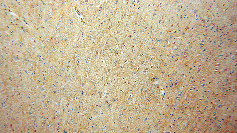 Immunohistochemical of paraffin-embedded human brain using Catalog No:111761(IMPA1 antibody) at dilution of 1:50 (under 10x lens)