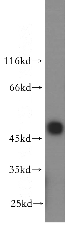 human brain tissue were subjected to SDS PAGE followed by western blot with Catalog No:116608(USP34 antibody) at dilution of 1:600