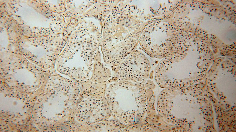 Immunohistochemical of paraffin-embedded human testis using Catalog No:113590(PARP11 antibody) at dilution of 1:100 (under 10x lens)