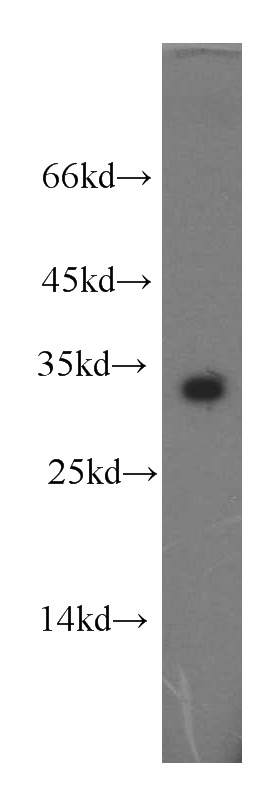 Jurkat cells were subjected to SDS PAGE followed by western blot with Catalog No:109352(CLEC2D antibody) at dilution of 1:500