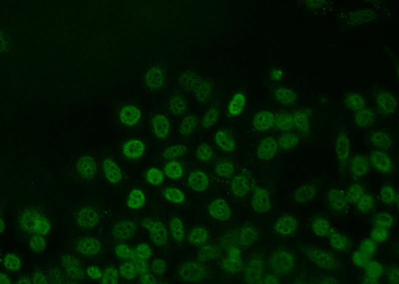 Immunofluorescent analysis of MCF-7 cells using Catalog No:111900(JUNB Antibody) at dilution of 1:25 and Alexa Fluor 488-congugated AffiniPure Goat Anti-Rabbit IgG(H+L)