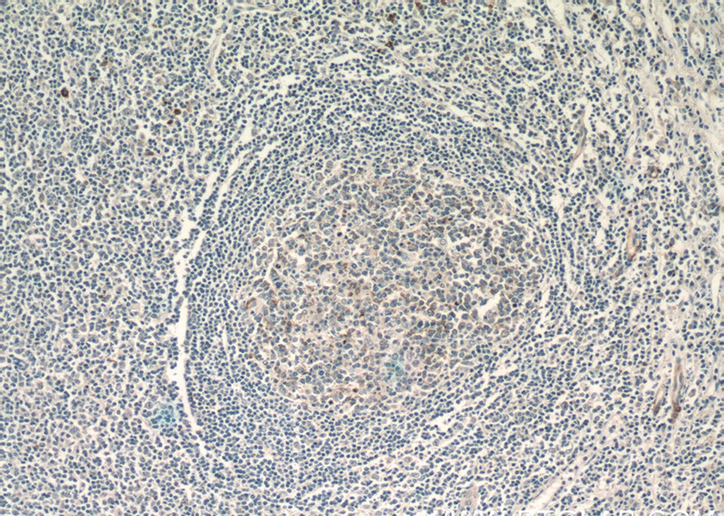 Immunohistochemistry of paraffin-embedded human tonsillitis tissue slide using Catalog No:109638(CXCL13 Antibody) at dilution of 1:50 (under 10x lens)