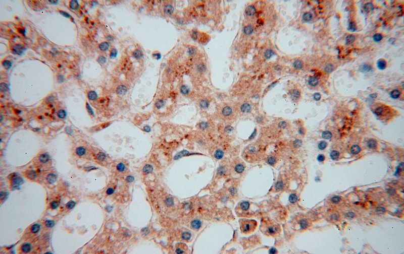 Immunohistochemical of paraffin-embedded human liver using Catalog No:113632(PDLIM7 antibody) at dilution of 1:100 (under 40x lens)