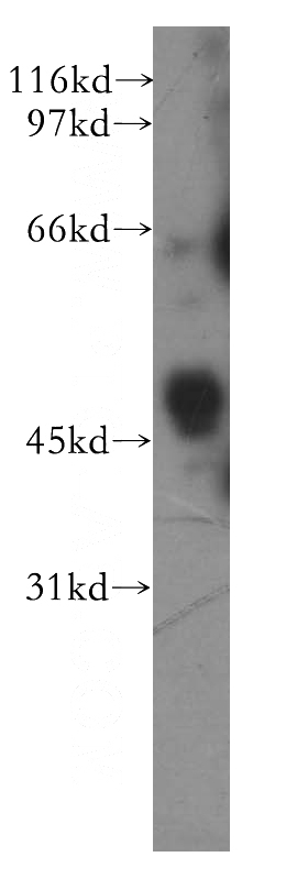 A549 cells were subjected to SDS PAGE followed by western blot with Catalog No:117218(BPIL1 antibody) at dilution of 1:400