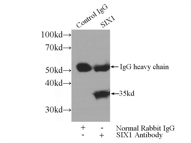 IP Result of anti-SIX1 (IP:Catalog No:115249, 3ug; Detection:Catalog No:115249 1:1000) with HEK-293 cells lysate 2560ug.