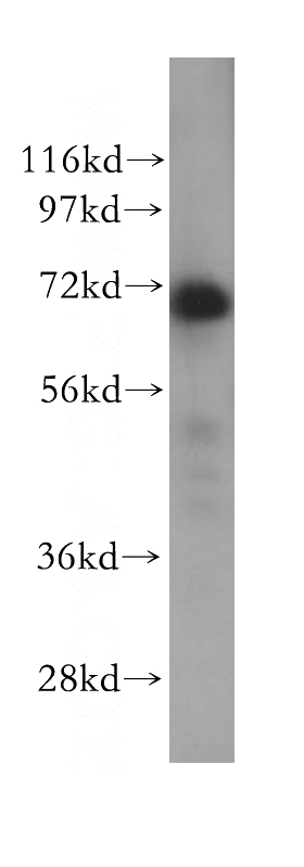 HEK-293 cells were subjected to SDS PAGE followed by western blot with Catalog No:114798(RPAP2 antibody) at dilution of 1:500
