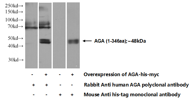 Transfected HEK-293 cells were subjected to SDS PAGE followed by western blot with Catalog No:107913(AGA Antibody) at dilution of 1:1000
