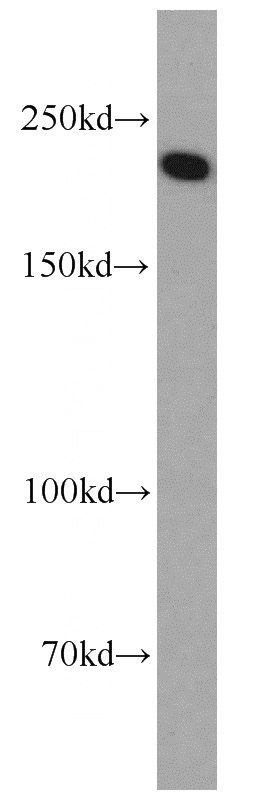 HEK-293 cells were subjected to SDS PAGE followed by western blot with Catalog No:115357(SLIT2-Specific antibody) at dilution of 1:600