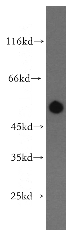 human brain tissue were subjected to SDS PAGE followed by western blot with Catalog No:114476(RASGEF1B antibody) at dilution of 1:300