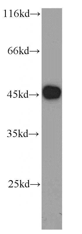 Jurkat cells were subjected to SDS PAGE followed by western blot with Catalog No:116720(VAT1 antibody) at dilution of 1:2000