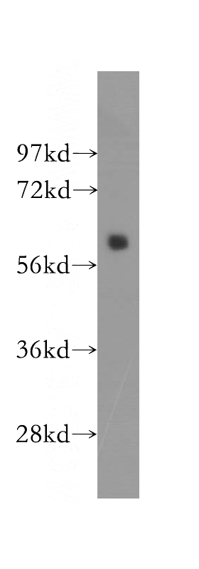 HeLa cells were subjected to SDS PAGE followed by western blot with Catalog No:115715(STK3 antibody) at dilution of 1:300