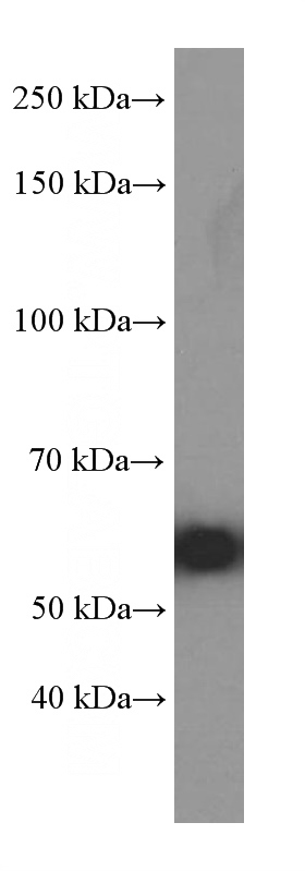 HeLa cells were subjected to SDS PAGE followed by western blot with Catalog No:107266(HSPD1 Antibody) at dilution of 1:4000