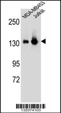 SF3B3 Antibody (C-term) (Cat. #166744) western blot analysis in MDA-MB453,Jurkat cell line lysates (35ug/lane).This demonstrates the SF3B3 antibody detected the SF3B3 protein (arrow).