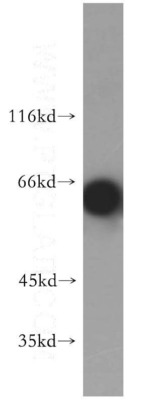 MCF7 cells were subjected to SDS PAGE followed by western blot with Catalog No:110180(EIF2AK2 antibody) at dilution of 1:2000