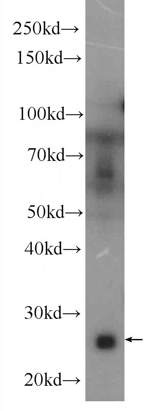 human blood tissue were subjected to SDS PAGE followed by western blot with Catalog No:108687(C1QC Antibody) at dilution of 1:800