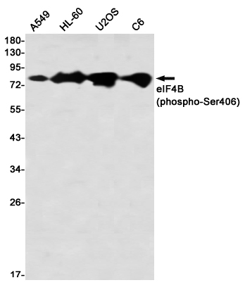 Western blot detection of eIF4B (phospho-Ser406) in A549,HL-60,U2OS,C6 using eIF4B (phospho-Ser406) Rabbit mAb(1:1000 diluted)